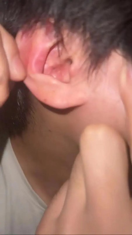“晚上睡觉，耳朵里的蓝牙耳机爆炸了” 同款在电商平台销量达百万6月10日，河南郑州一名大学生在社交媒体发布视频称，晚上睡觉时，其佩戴的无线蓝牙耳机在耳朵内发生爆炸